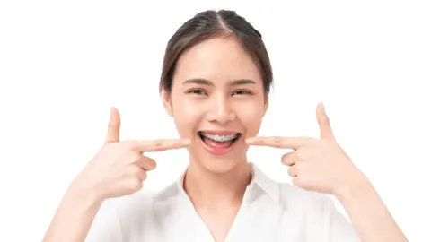 Explore Orthodontic Braces: Overview, Basics, Facts & Helpful Resources